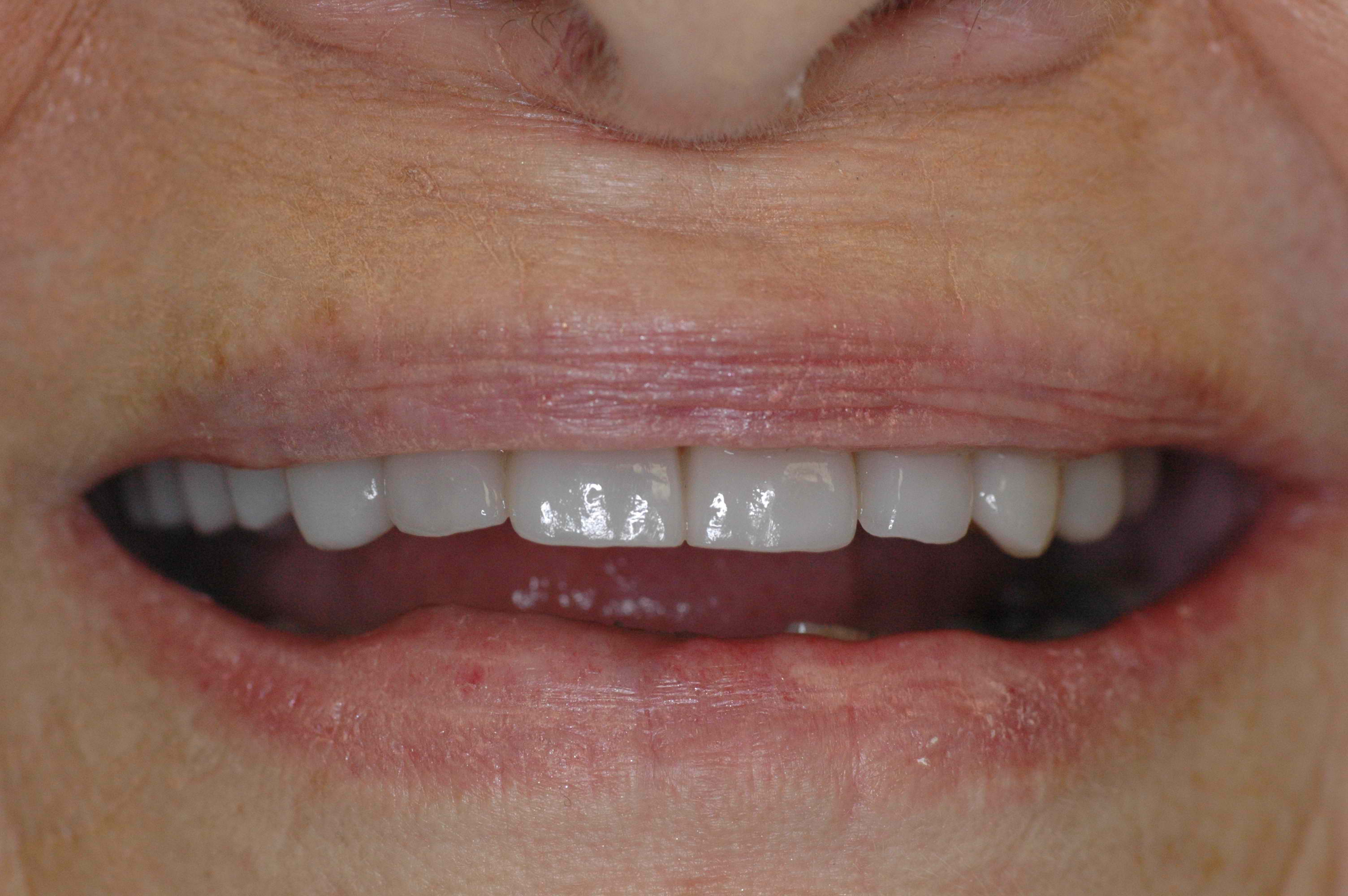 McCandless Cosmetic Dentistry - after photo